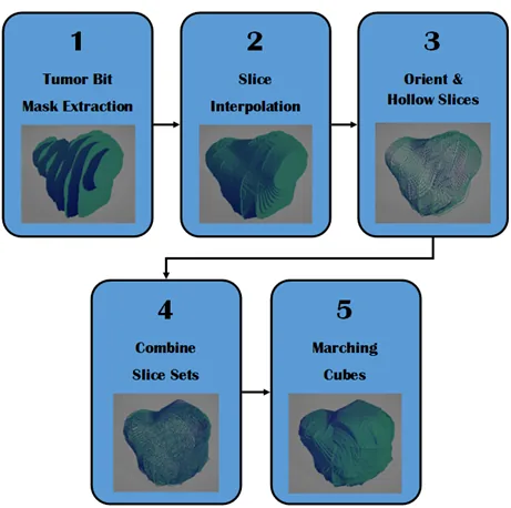 Diagram of the MRI-to-3D-model processing pipeline